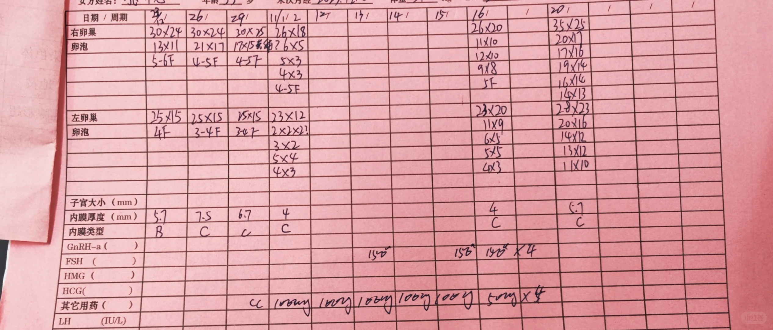 试管流程-微刺激-1 就诊:付志红,和美佳代孕