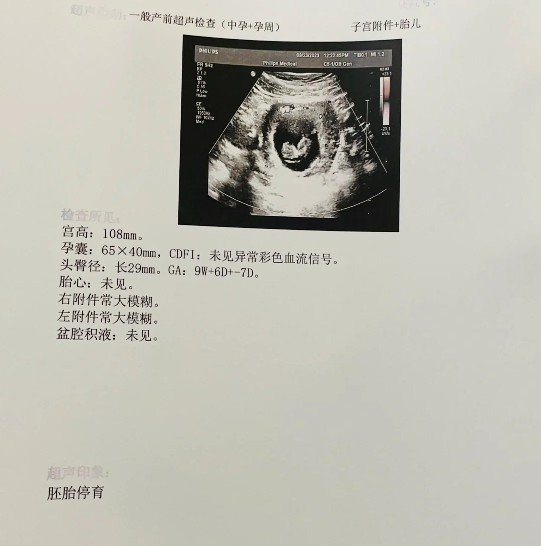 胎停了，梦碎了。不要再来接好孕了！