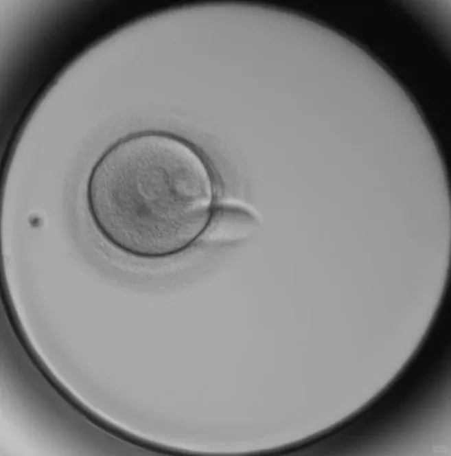 备孕这么久 才发现根本没排卵！