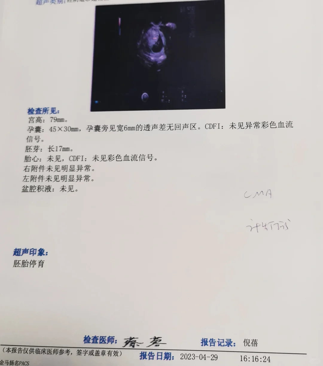 大龄头胎胎停两次，伤不起啊